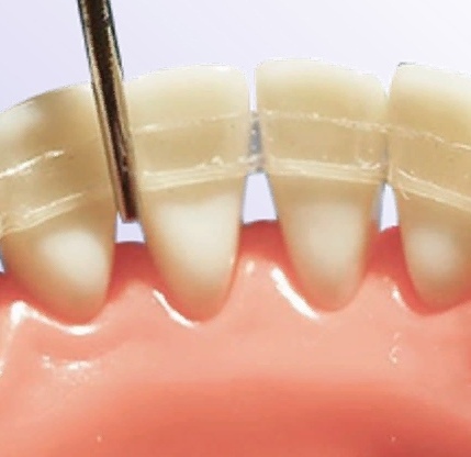 <span style="font-weight: bold;">Шинирование </span>