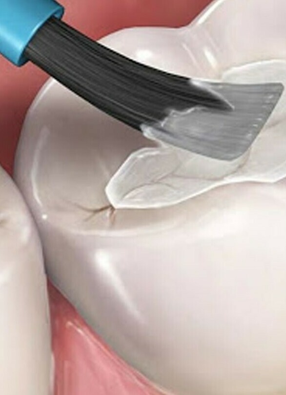 <span style="font-weight: bold;">Герметизация</span>